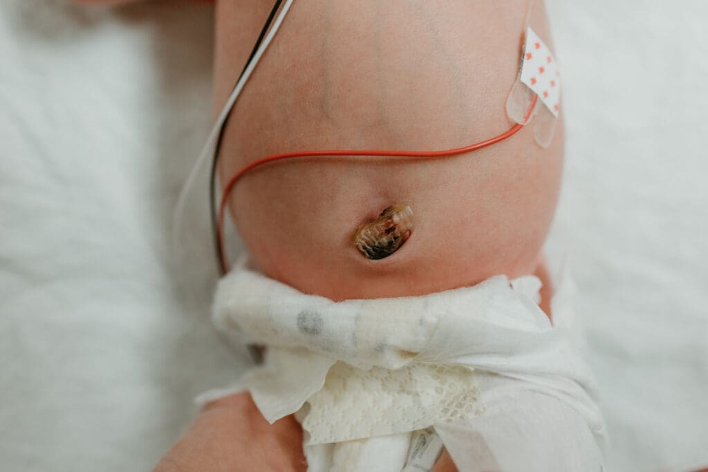 NICU Fresh 48 session at Vanderbilt University Medical Center in Nashville