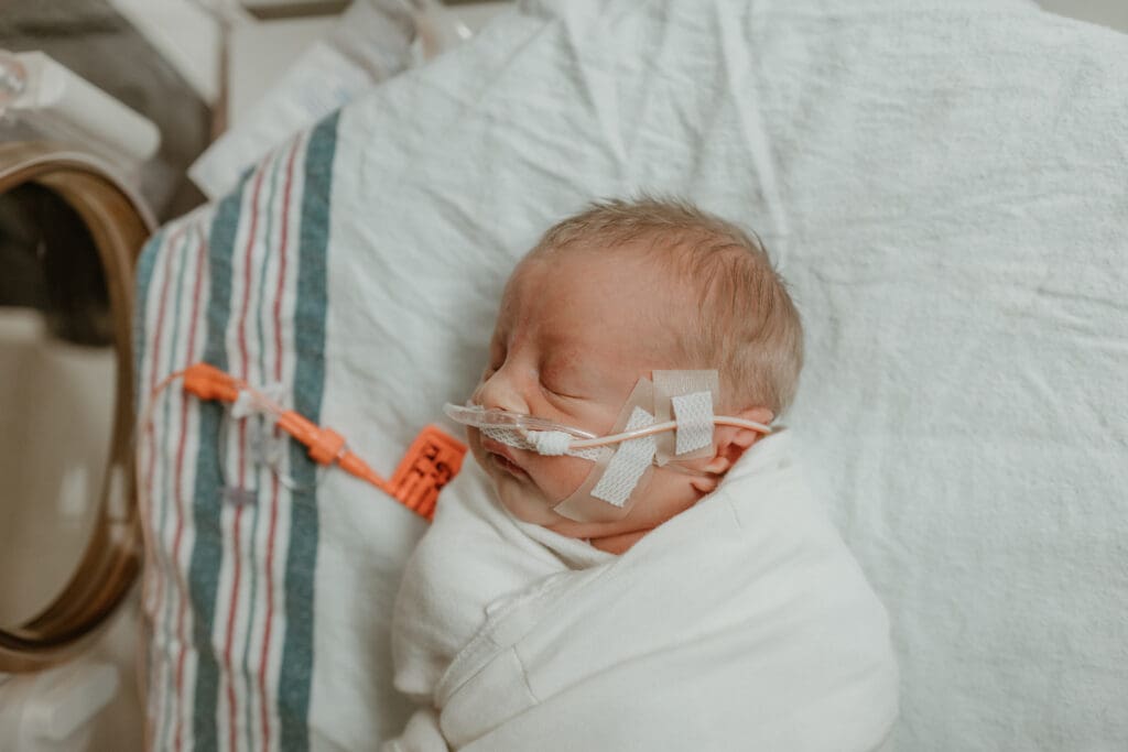 newborn baby with oxygen on and a feeding tube in the NICU