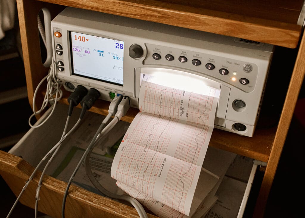 photo of a fetal heart rate and contraction monitor taken by birth photographer during mother's labor